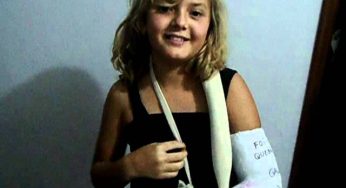 Caroline Goulart com o braço quebrado