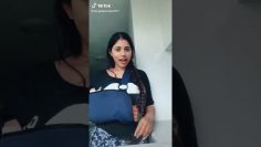 Girl with a broken arm
