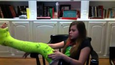 showing off my new cast!