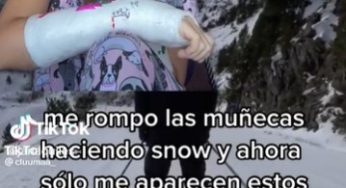 Mi vida 🫠 – Broken both arms – Janaquiles