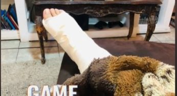 Women with broken ankle, leg cast