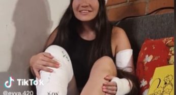 Evva.420 Sexy colombian women in plaster cast