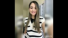 Clip 12 Double CAST – Accident playing basketball fractured wrists
