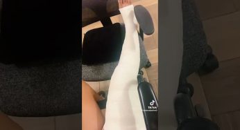 Clip 2 Accident of football LONG LEG CAST woman 😍