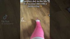 Clip 4 LONG LEG CAST PINK #legcast #pink
