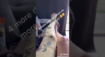 LONG LEG CAST WOMAN TIK TOK
