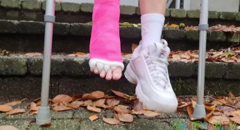 #shorts #longlegcast #fracturedfoot Long Leg Cast