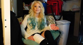 Talking about her plaster full leg cast
