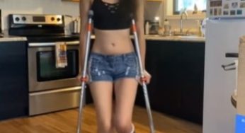 Sexy nails with broken leg