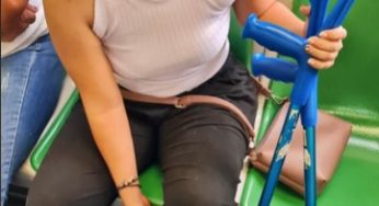 Colombian women in plaster leg cast