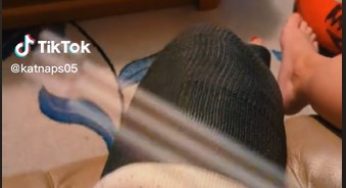 when your cast itches but you’re a wizard
