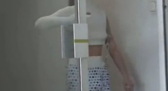 Risser’s Stagnara Body Plaster Cast with Shoulder Spica