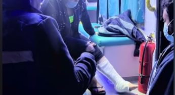 Women has a accident as result in leg cast