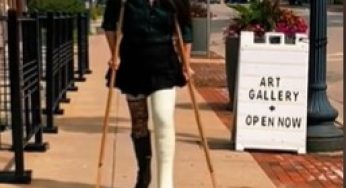 Perfect women in a leg cast in the street