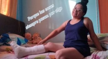 Broken leg … but i am happy hohoho
