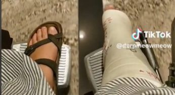 I fractured my ankle a few weeks ago