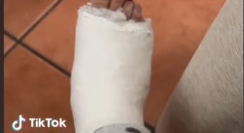 Nice leg in plaster cast… perfect pedicure