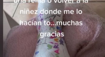 Plaster leg cast at home