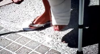 Women broken leg in the hospital