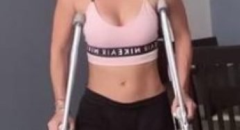 Mexican model in a leg cast SLC