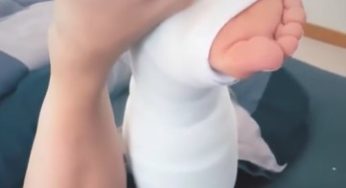 Leg cast with sexy white nails