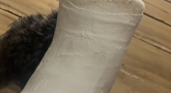 Plaster leg cast SLC