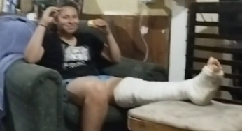 Broken tibia long leg cast LLC