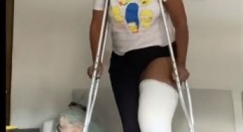 Women sexy plaster long leg cast LLC