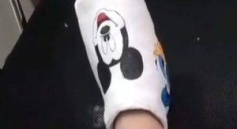 Mickey cast leg