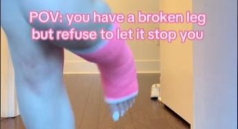 Sexy model with pink leg cast in a normal day