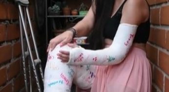 ¿Cómo terminé con un brazo y una pierna enyesados?