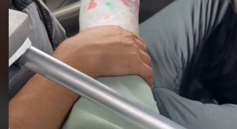 I have to go to work plaster leg cast
