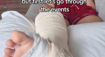 Broken leg after fall in a horse