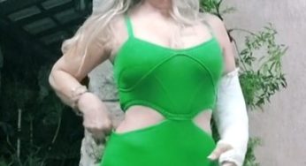 Women with broke arm