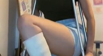 Leg cast do you believe?