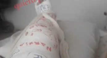 I broke my leg now in a full cast
