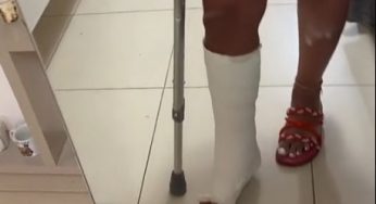 Perfect pedicure with plaster leg cast SLC