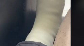 Sexy singer with fiber perfect leg cast