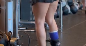 Purple leg cast SLC