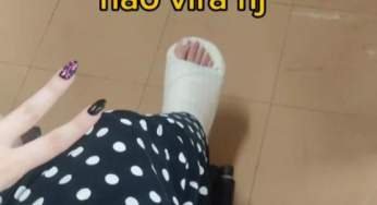 Leg cast in a wheelchair