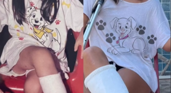 Sara watanabe in super sexy plaster leg cast
