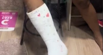 Nice plaster leg cast SLC in the mirror