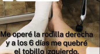 First i broke my knee and after broke my ankle