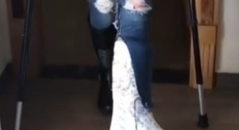 Sexy model with broken leg SLC
