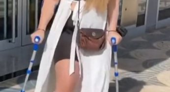 Nice model with broken leg and sexy black nails