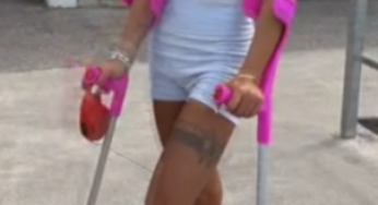 Pink leg cast with her Pet