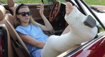Plaster leg cast in a car, perfect texture