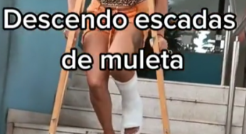 descendo escadas with plaster leg cast