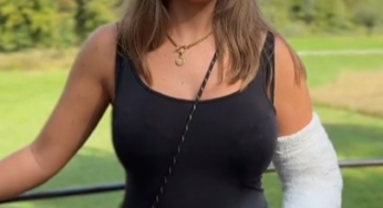 Big arm cast LAC