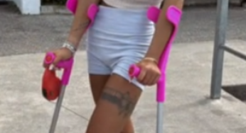 Nice pink leg cast SLC